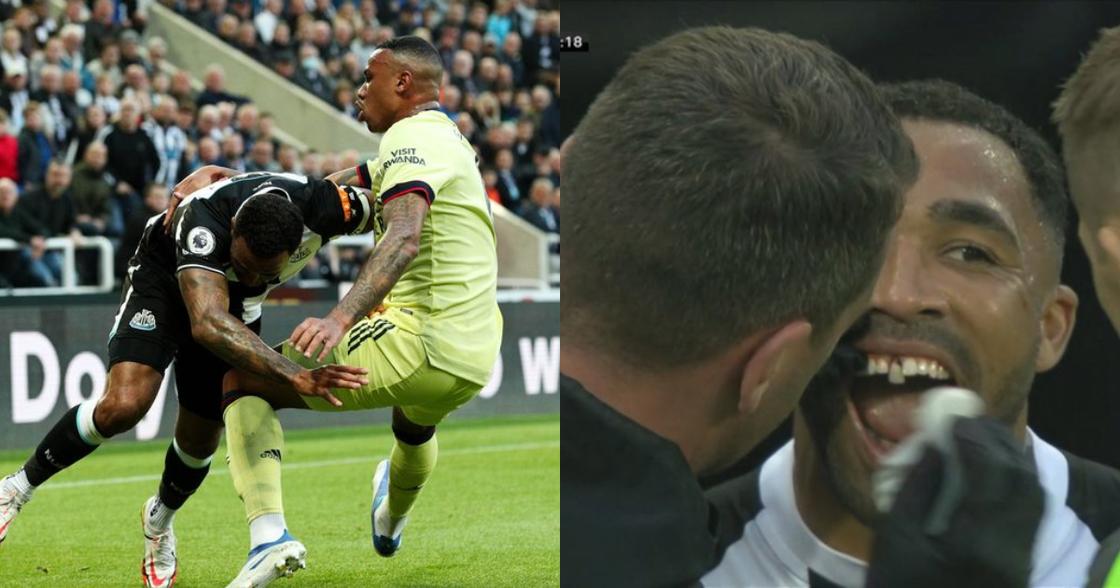 Newcastle Forward Callum Wilson Suffers Gruesome Injury During Clash ...