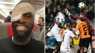 Antonio Rudiger Sends Classy Message to Fans After Getting 20 Stitches for His Sickening Head Injury