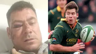 Former Springbok Player Grant Esterhuizen Assaulted After All Blacks Test Match in Mbombela