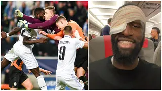 Latest photo of Antonio Rudiger shows the Real Madrid defender can't open his eye after head injury