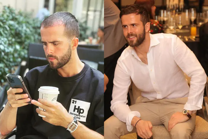 Miralem Pjanic's hair before and after